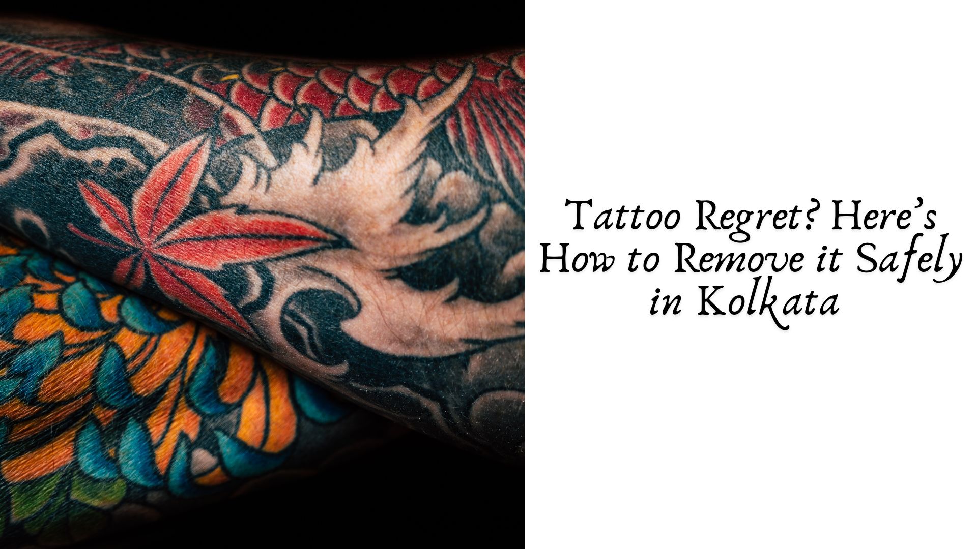 Tattoo Regret? Here’s How to Remove it Safely in Kolkata 