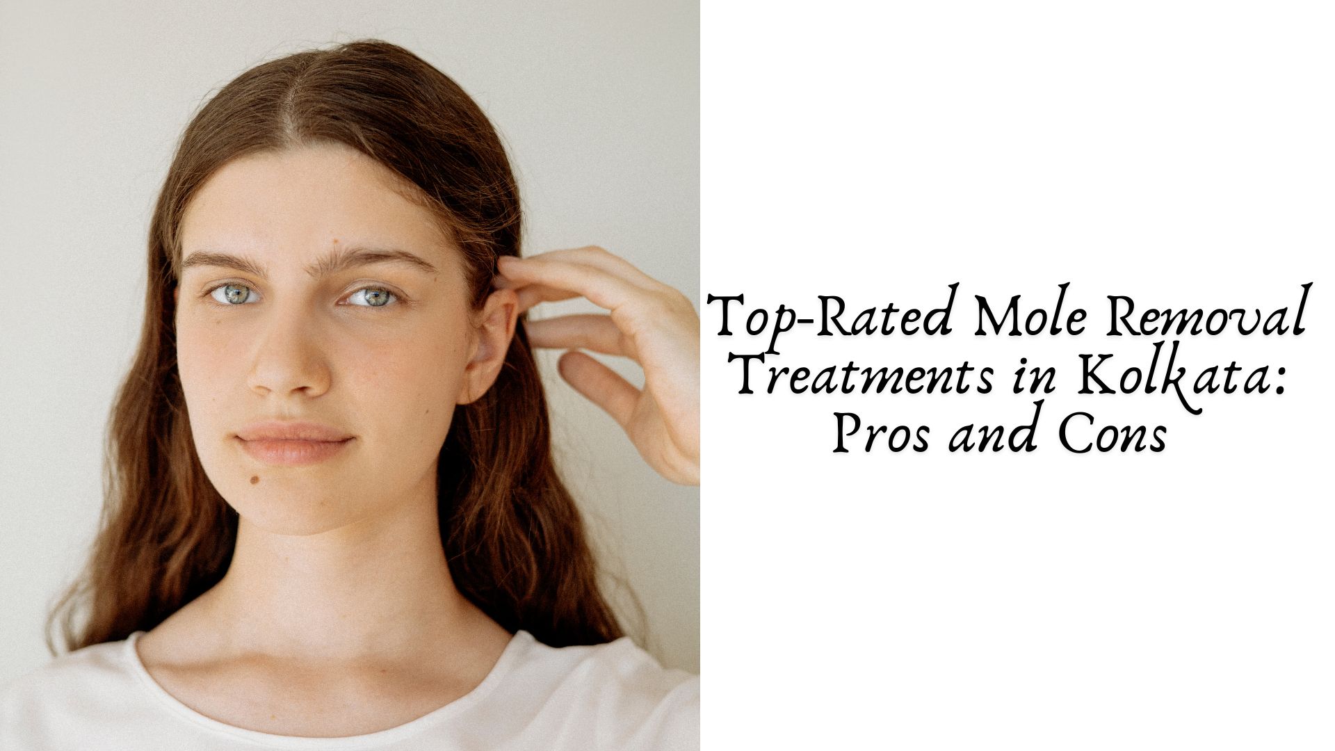 Top-Rated Mole Removal Treatments in Kolkata: Pros and Cons 